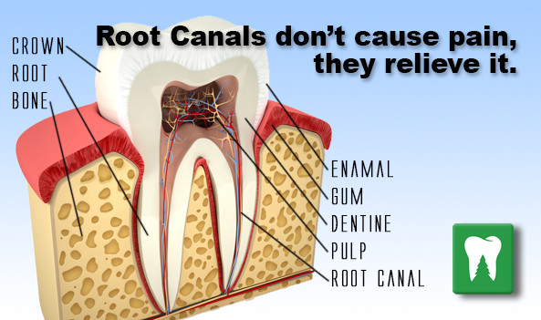 How Painful Is a Root Canal?