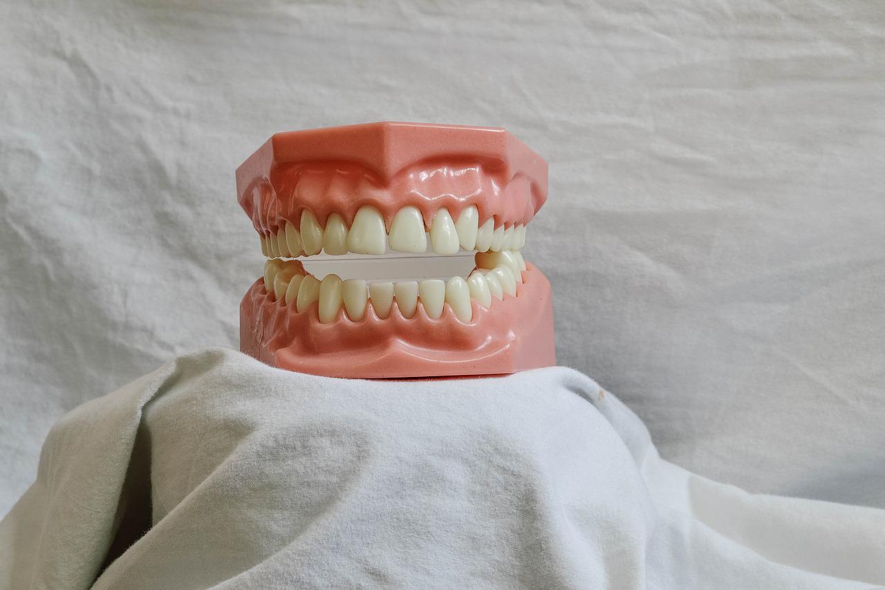 teeth, dental, dental model-5522650.jpg